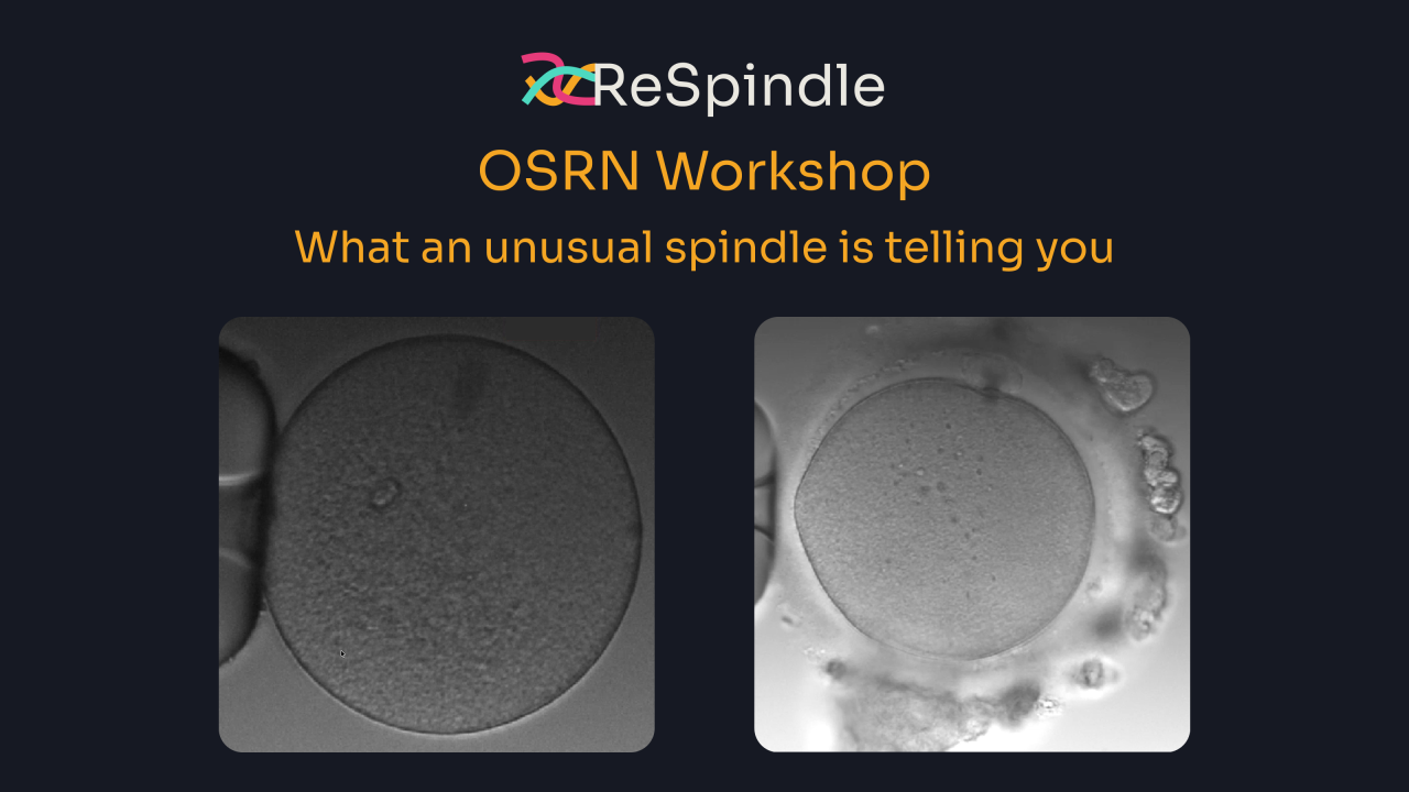 OSRN Workshop - What an unusual spindle is telling you