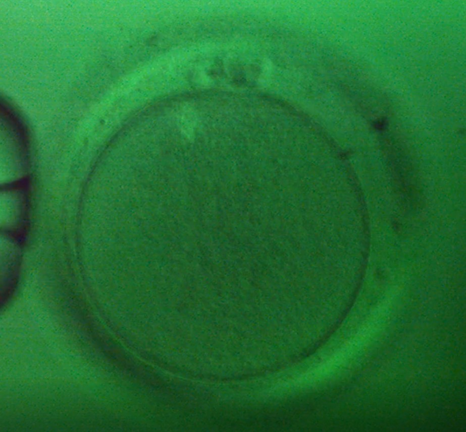 Oocyte 2