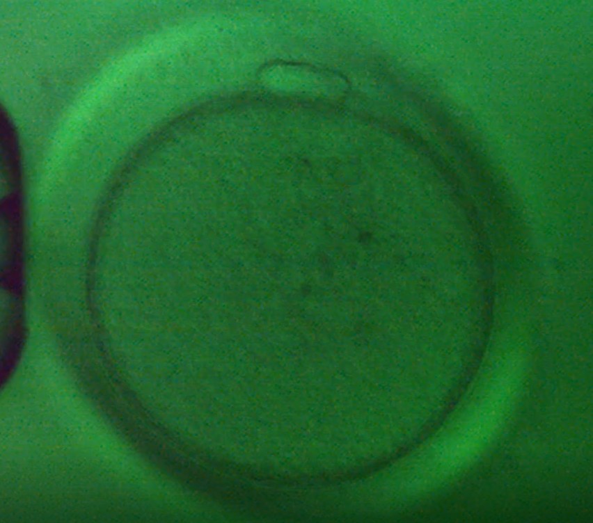 Oocyte 3