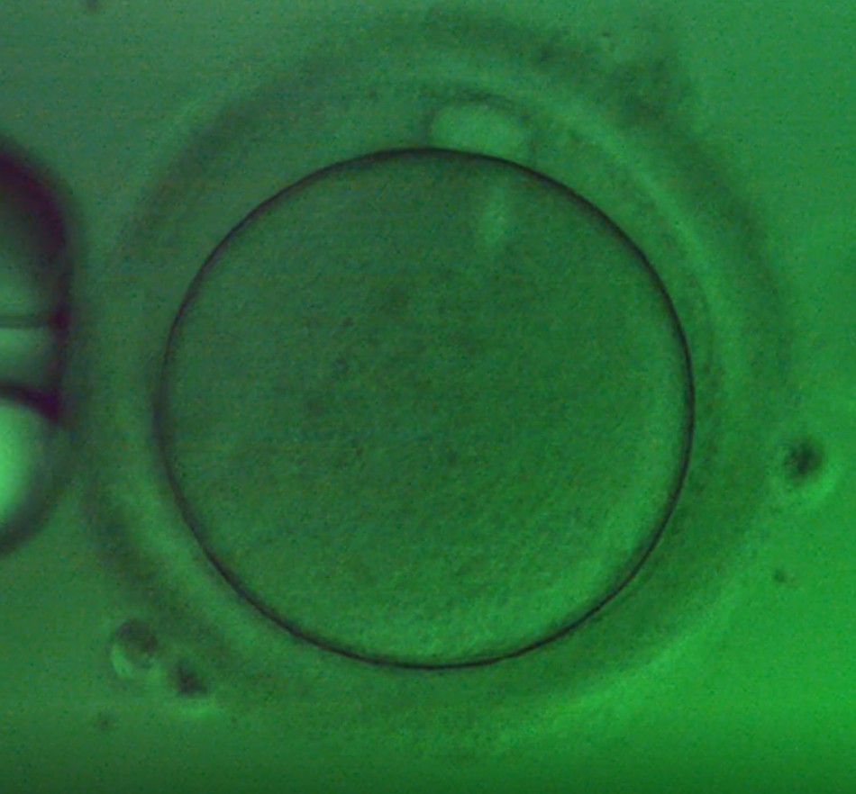 Oocyte 4