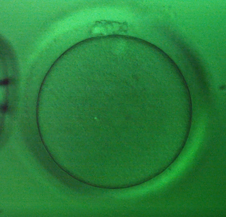 Oocyte 5
