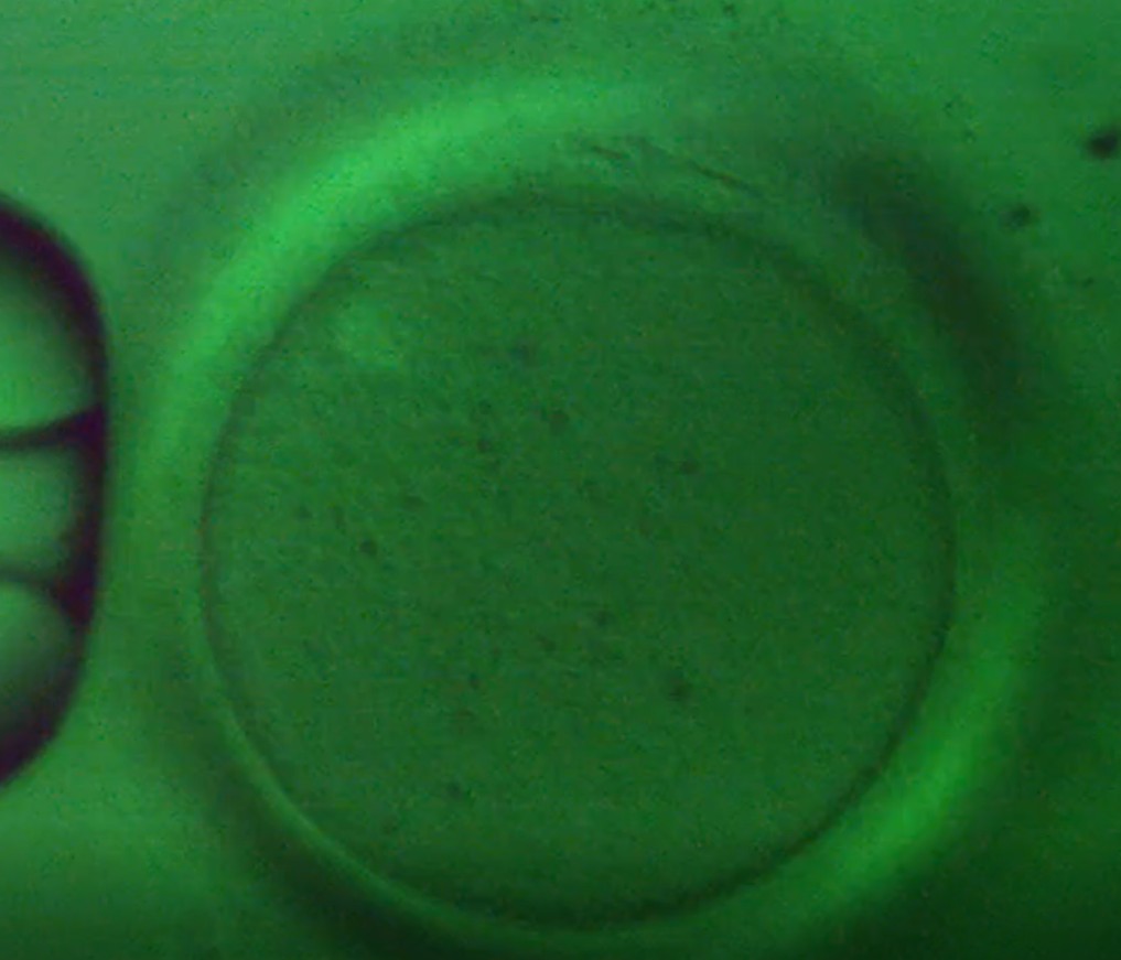 Oocyte 6