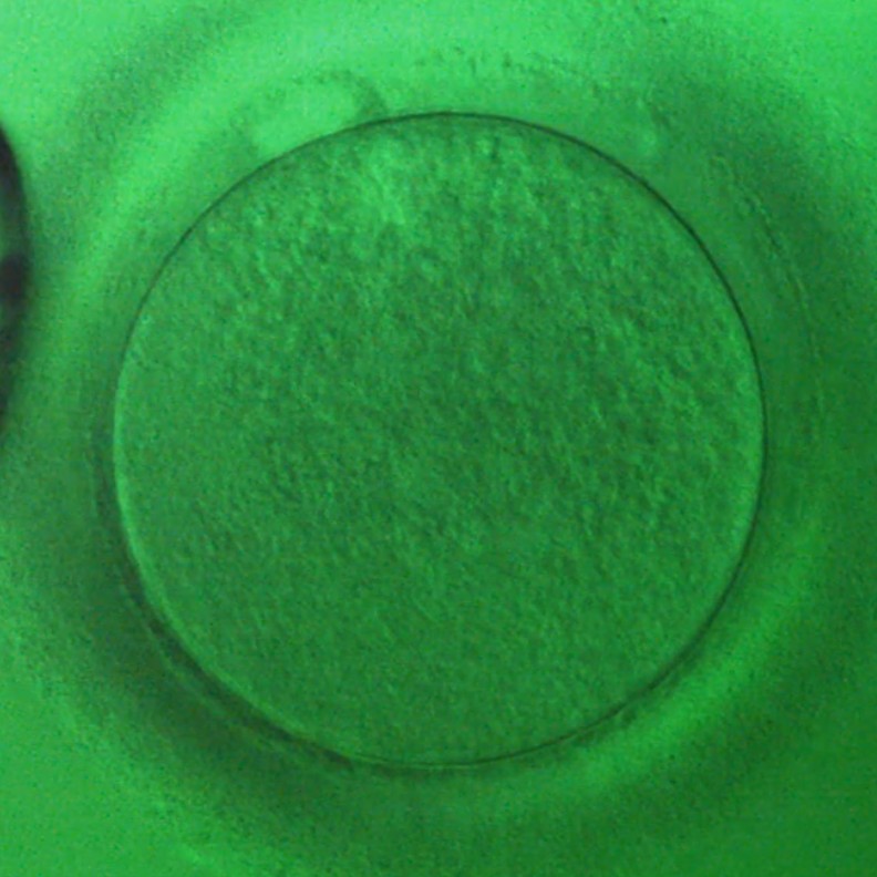 Oocyte 7
