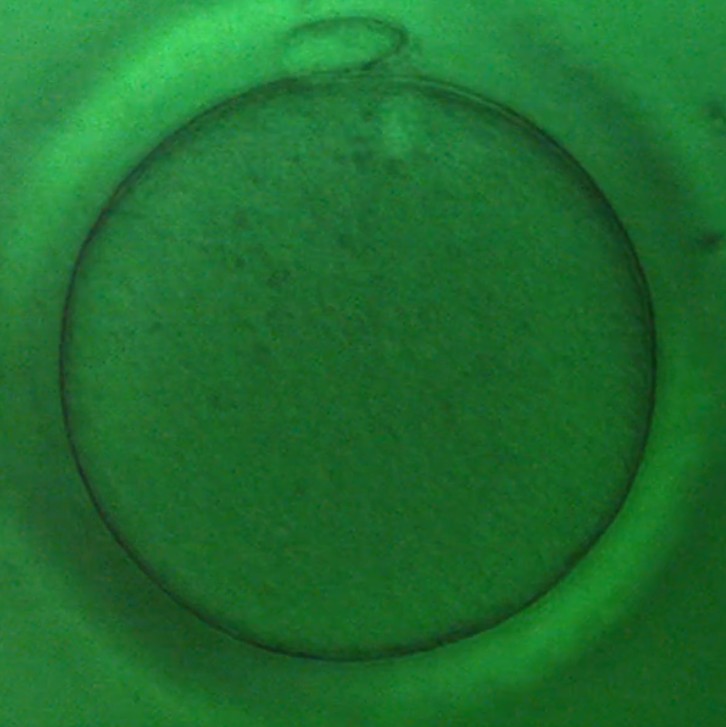 Oocyte 9