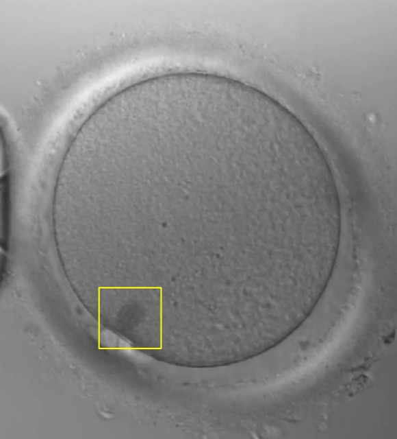 Oocyte